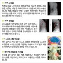 배장호 | <허리디스크 치료 후기> 허리디스크 디스크제거술로 수술받았습니다.