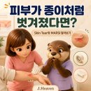고령 환자 피부가 쉽게 찢어지는 이유, Skin Tear와 MARSI 구분하기 이미지