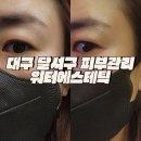 대구 달서구 피부관리 잘하는 곳 월성동피부샵 추천 워터에스테틱 물방울관리 후기