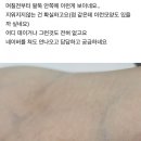 백신 접종자의 피부에 나타나는 &#39;육각형 벌집 구조&#39;는 &#39;신체 인터넷&#39;(IoB)의 발현이다! 이미지