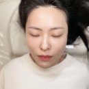 준아트 | 청라두피관리 [준아트] 헤어라인 자연스럽게 달라진 후기