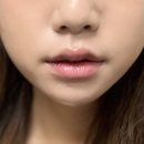 지에스(GS)25양정퀸즈점 | [부산 연제] 부산시청피부관리 여드름 진정 관리 후기 | 붉어짐 없이 정리된 변화 기록