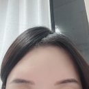 아쿠아헤어 | 헤어라인 고민 있다면 주목! 닥터그루트 아쿠아 PDRN 헤어라인 케어 솔직 후기