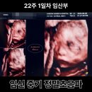 세신정밀 | 임신 22주 차ㅣ새봄여성병원 2차 중기정밀초음파 후기ㅣ검사 시간 및 항목, 비용