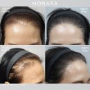 여성헤어 이미지