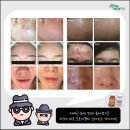 트로이홈케어