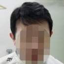 모라인 | [안양가발 모라인] 수많은 후기로 인증된 맞춤가발 업체