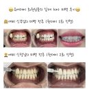 지디치과의원 | 👰‍♀️드디어 시작해보는 예신 관리, 치아미백부터🦷(유어데이 특별 이벤트🤍)