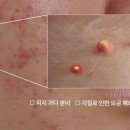 [공지] 5월 공구템(베몽테스 악신부스터) 1+1 초핫딜