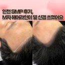 학익1차 하나아파트 | 인천두피케어 잘하는 혜지오 인천탈모커버 후기