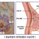 2. 피부 부속기관의 구조 및 생리(젖샘) 이미지