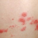 대상메디칼 이미지