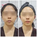 루시아치과의원 | 루시아 에스테틱 | 김포 장기동 웨딩관리로 유명한 에스테틱 작은얼굴 피부관리 받으러 다녀왔어요 :)