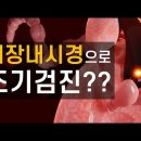 대장내시경을 통한 대장암 조기검진의 가치는 얼마나 될까? 이미지