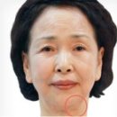 훌륭성형외과 이미지