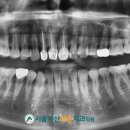 수연합치과기공소 네이버블로그