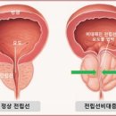 전립선암 예방에 좋은 식단 이미지