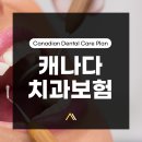 ✅[성공한사람들] 캐나다 치과보험혜택 CDCP! 나도 해당될까? - 자격요건 알아보기 이미지