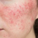 라메스피부과의원 이미지