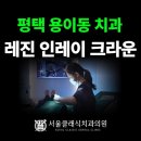 대화치과기공소 | 평택 용이동치과_ &#34;레진,인레이,크라운 구분하는 방법?!&#34; _평택 서울클래식치과