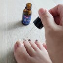 케어셀라 | 바르는 발톱무좀케어] 큐어유 셀라솔루션 문제성 발톱 집중관리템