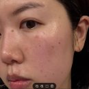 (주)마디메디칼 | 천안피부관리 신부동 두정동 피부관리 기미 미백 홍조 잡티 관리보다 피부를 먼저 봅니다.