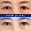 아이케이성형외과의원 네이버블로그