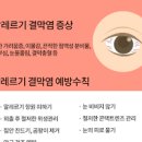 유행성 결막염 증상 전염 치료 알레르기 결막염 눈병 증상 이미지