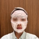 연세의원 | 합정역 연세보드미의원 편평사마귀 제거 6개월차 후기