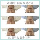 건대피부관리 리바에스테틱 표정근육 비대칭관리 #림프관리 #노폐물배출