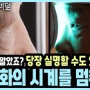 20대 안구건조증이 60대 망막 상태가 된 충격적 이유! 당신의 눈 노화 I KBS 생로병사의 비밀 20260401방 이미지
