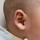 대학천사약국 | 신생아 뾰족귀 교정 후기 - 울산대학교병원 이비인후과