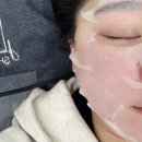 제이메디칼 | 광주 리프팅 추천 알테온으로 탄력·브라이트닝까지 한번에 관리 후기