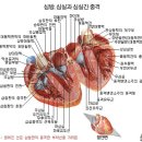 심혈관 질환이란? 이미지