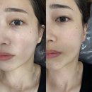 부천 신중동 피부 속부터 채우는 LDM물방울 관리 후기, &#39;람스킨케어 부천점&#39;