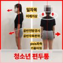 부산 동래 편두통, 청소년 회원님 두통 10회 운동 개선후기