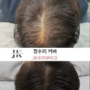 제이부티크 | 수완동탈모 자연스럽게 케어받고 싶다면 제이케이두피부띠크 후기 ❤