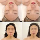 이손화장품 | 신도림 웨딩관리 예신 윤곽 잘하는 에스테틱 엘뷰티레메디