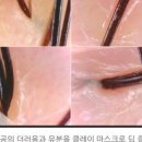 미라클힐링센터 네이버블로그