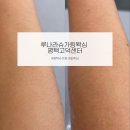 루나라슈가링왁싱 평택고덕센터 | 팔 하프 슈가링 솔직 후기