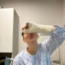 게으른 반달 | 주상골&amp;반달 뼈 골절 사고 후기| EP.2 골절 판정 후, 수술 그리고 통깁스까지 ..