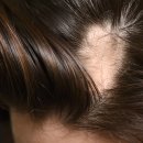 연세모벨르의원 이미지