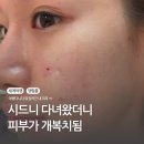 차스킨광주점 | 광주 서구 피부과 스킨부스터 셀르디엠 1~3일차 후기