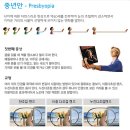 일립스안경 이미지