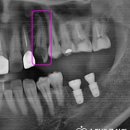 송탄바른치과의원 이미지