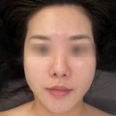 가인스킨샵 | 의정부역 피부관리 에스테틱샵 가인미가 의정부 윤곽관리 잘 하는 곳