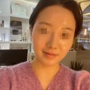 수원 인셀덤러블리웰라 피부관리 부세부 무료체험 후기