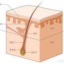 모낭염 이미지