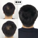 [경북 영주] 두피 문신 전문숍 &#34;닷더닷프로젝트&#34; 방문 후기, 내 머리에 생긴 마법 같은 변화!