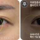 에스원성형외과의원 이미지